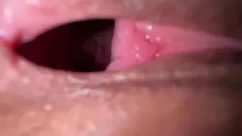 WIDE OPENED Pussy internal of 18 years old beautiful girl