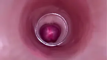 Female Insemination - Internal Camera Captures Deep Male Ejaculation