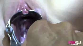 Fetish Freak Scene Cervix exam with a XXL sakura speculum