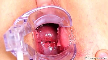 Chubby Teen Nurse Gets Fucked With Speculum